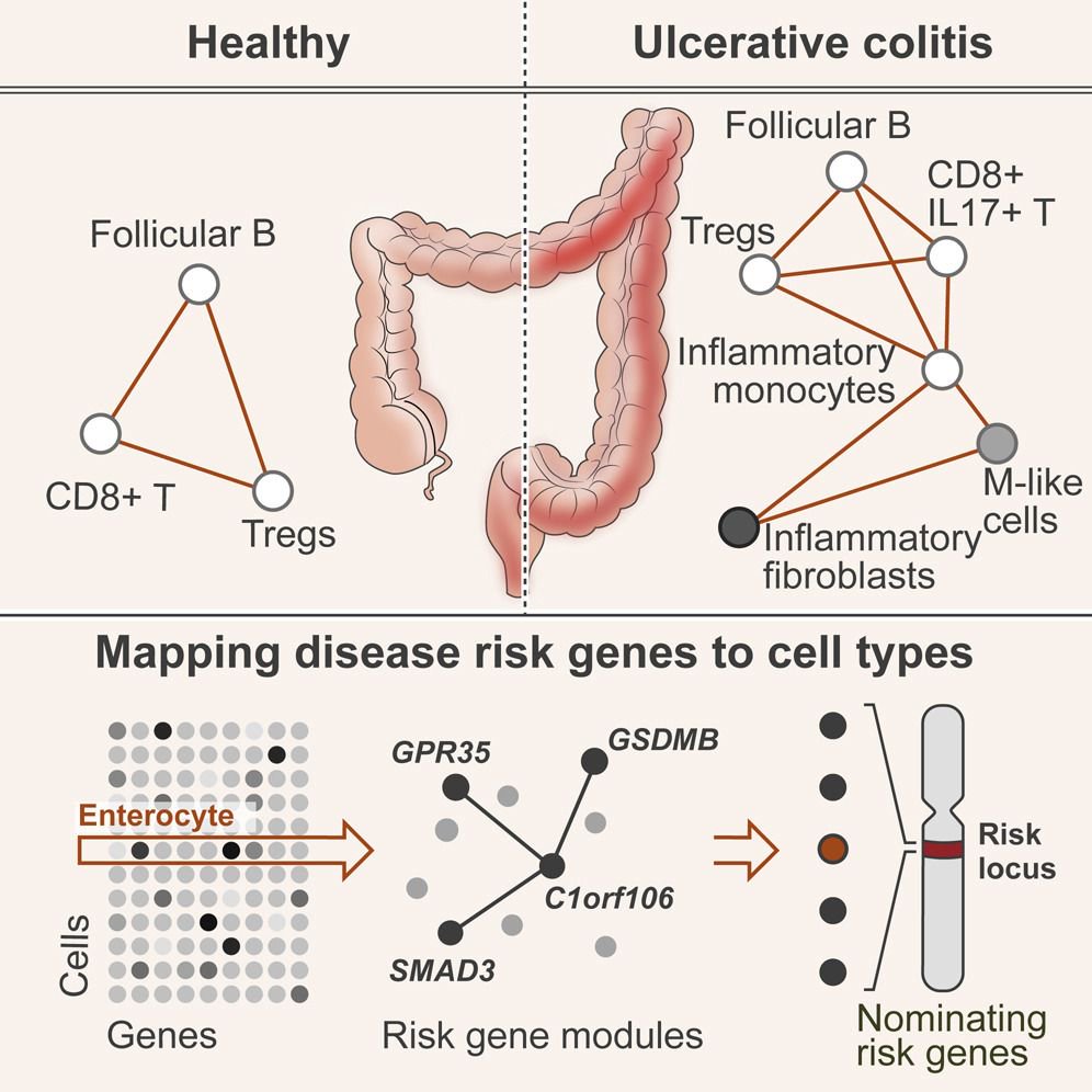 mmw_lmw's tweet photo. #HumanColon during #UlcerativeColitis | 51 cell subsets in colon mucosa | Co-expression of genes within cells allows inference of causal genes across risk loci | Aviv Regev @broadinstitute @CellCellPress https://t.co/QSHpwWixEf https://t.co/ykJfvRvxdc