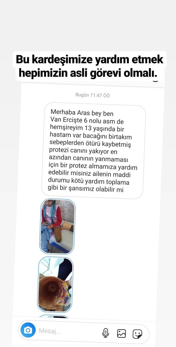 Aras Ali Altıntaş (@aras_ali_) on Twitter photo Etrafınızda bağış yapabilecek protez firmaları var ise lütfen bilgilerini paylaşın iletişime geçelim. <a href="/haluklevent/">Haluk Levent ( Ahbap Ekibi )</a> <a href="/drfahrettinkoca/">Dr. Fahrettin Koca</a> <a href="/seferaycan/">Prof. Dr. Sefer Aycan</a> Etrafınızda bağış yapabilecek protez firmaları var ise lütfen bilgilerini paylaşın iletişime geçelim. <a href="/haluklevent/">Haluk Levent ( Ahbap Ekibi )</a> <a href="/drfahrettinkoca/">Dr. Fahrettin Koca</a> <a href="/seferaycan/">Prof. Dr. Sefer Aycan</a>
