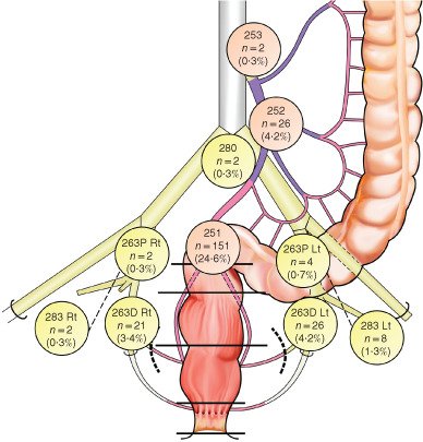 BjsOpen's tweet photo. New on Early View: Prognostic impact of residual lateral lymph node metastasis after neoadjuvant (chemo)radiotherapy in patients with advanced low rectal cancer https://t.co/7AAkjhLwR7 https://t.co/XKaf4AC8pt
