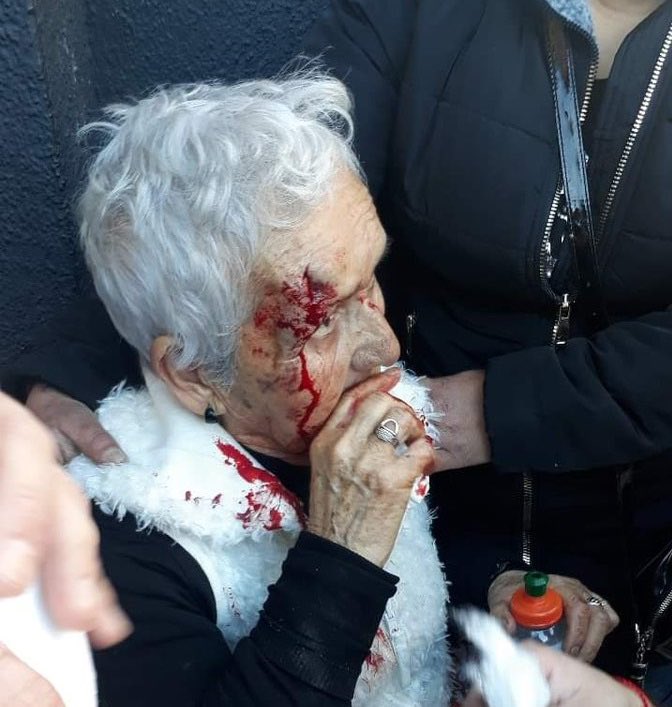 Carabineros no olvidemos este atentado que ustedes cometieron con ella