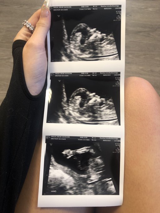 4 months 🥰 1st trimester is over! https://t.co/bUOEC65j5w