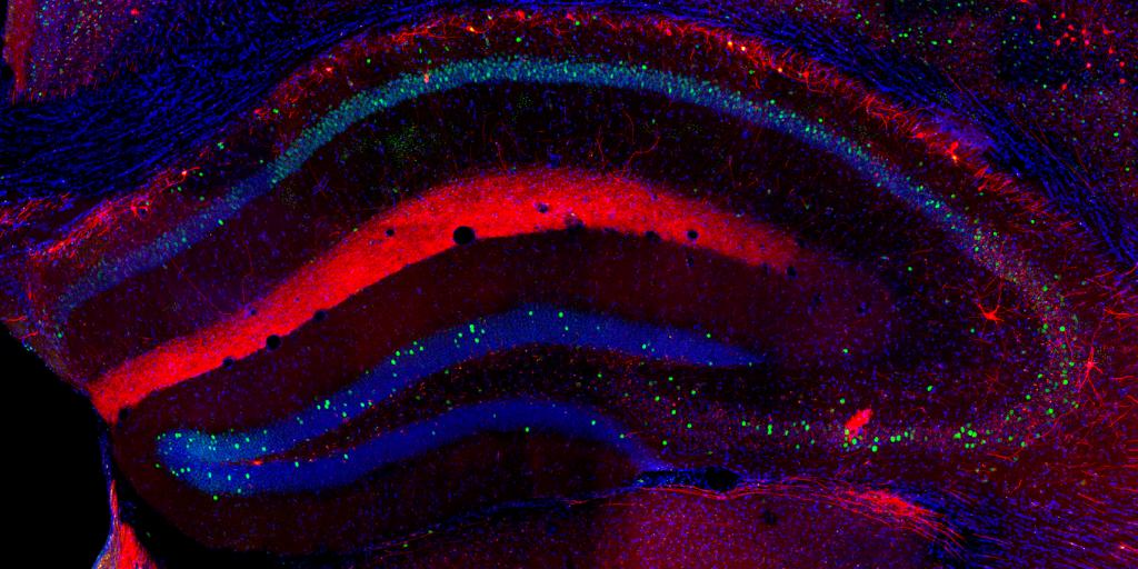 Evident_LS's tweet photo. This recent #micrograph from @FdnDouglas Imaging Contest demonstrated how hippocampal OLM interneurons coordinate excitatory neural networks during memory retrieval. 

Credit: Younes Valibeigi and Lorène Penazzi
Technique: Confocal laser scanning microscopy on an Olympus FV1200 https://t.co/lEOzvc7NPV