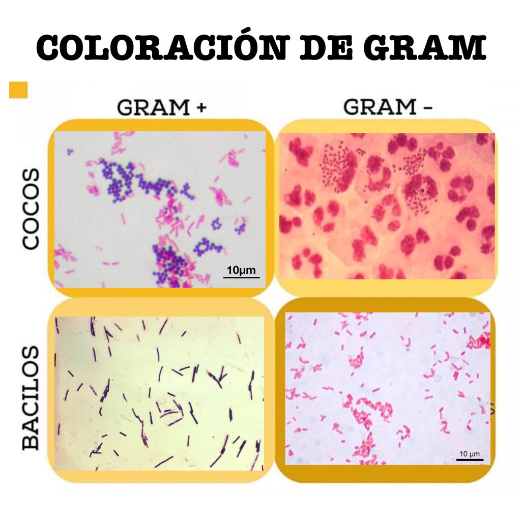 SVINFECTOLOGIA on Twitter: "¿QUE ES EL GRAM? La tinción de Gram es un  método de identificación bacteriana creado por el bacteriólogo danés  Christian Gram (1853-1938). Con esta coloracion se logra diferenciar al