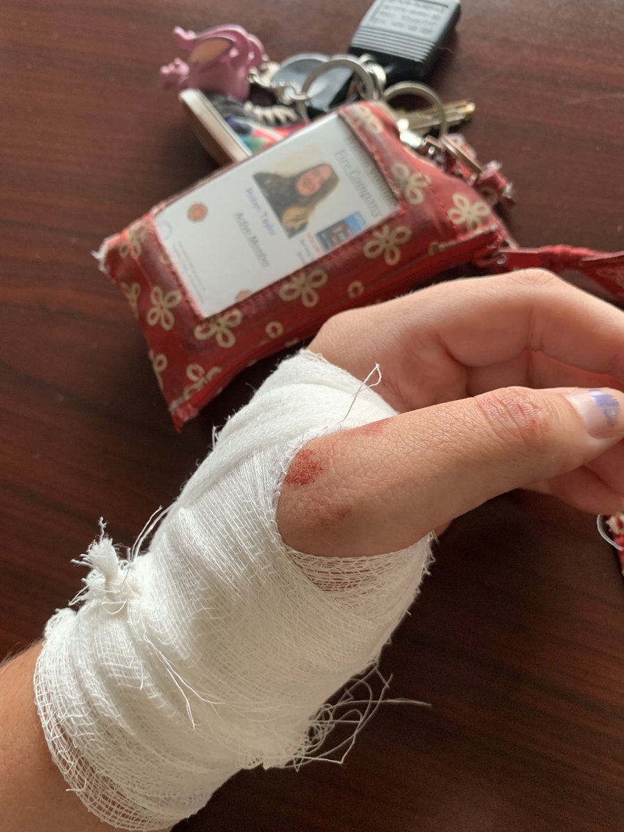 Toasty767's tweet photo. This morning my Rescue Squad friends had to bandage me up after I accidentally stabbed myself with my knife 🤣 it was a small cut but so deep it needed stitches 🤣 lost a lot of blood but I’m good now! https://t.co/Z8b8G2zFy6