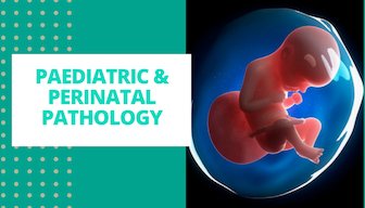 PathologyWeek19's tweet photo. Avail Early Bird Discount !! Hurry up @PathologyWeek19 
Confirm your lucky slots Now!!
 #pathology #doctors  #pathologist #medicine #health #diagnostic #hospital #doctor #travel #nurse #travel 
get the slots at lowest prices,Hurry up!! https://t.co/CA1dakCCQ3