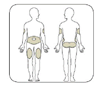 DocQueer's tweet photo. Here's a picture of safe subq injection sites. Hopefully, QueerDoc answered all your questions about subcutaneous injections this week. If not send us a message! #SUBQNOTIM #transgenderhormones #nonbinaryhormones #lesspainmoregain https://t.co/g6QdWBQrec