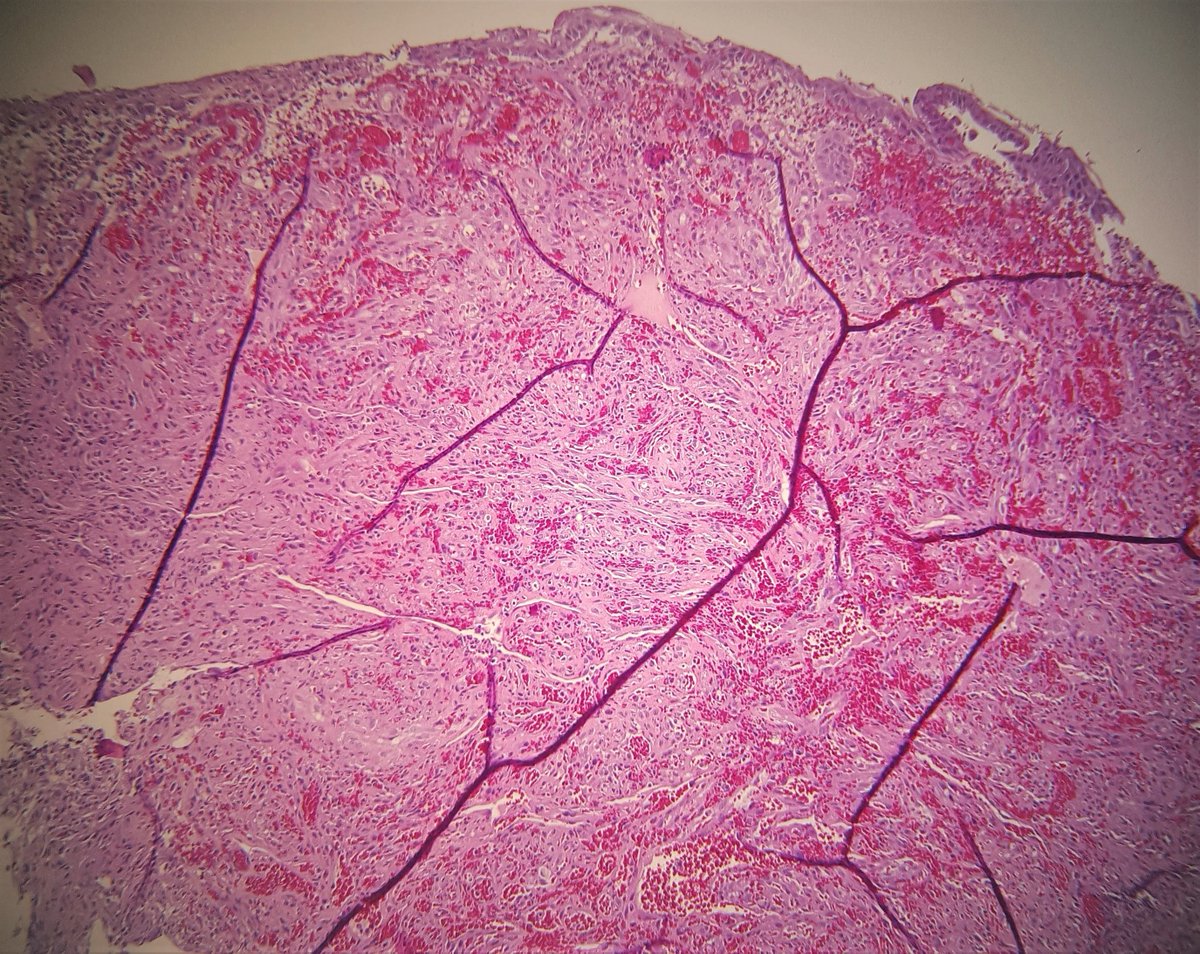 UAB Pathology tweet media