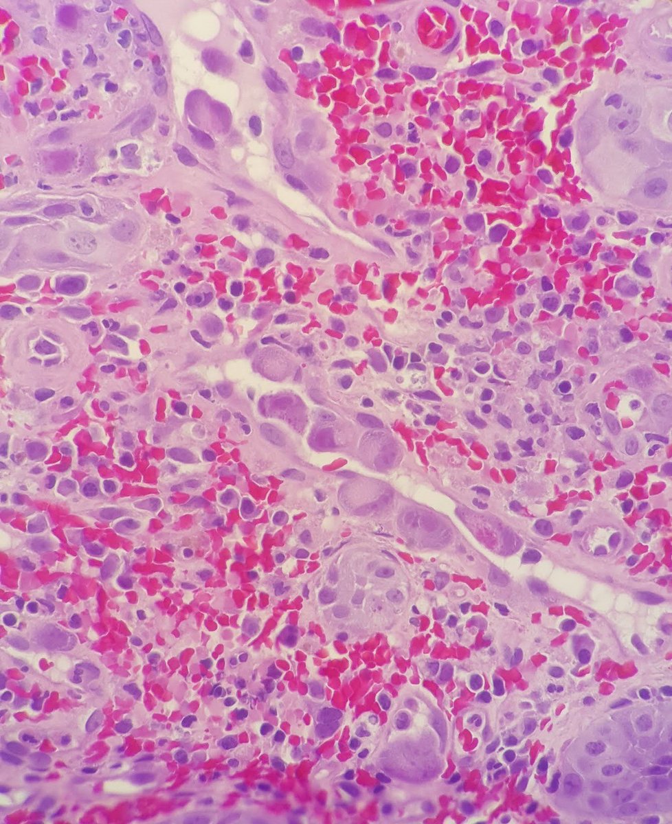 UAB Pathology tweet media