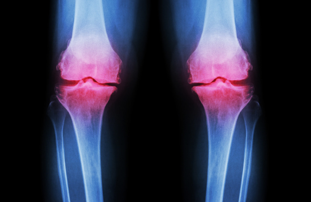 thekneedoc's tweet photo. Here is how to read an #MRI of a #NormalKnee https://t.co/zhjkSQ3HNr https://t.co/5PeiRobi0k