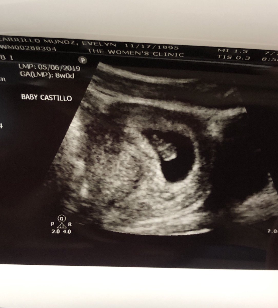 eve_castillo1's tweet photo. I just pray my baby is born healthy 💙💓 idc if it’s a girl or boy, I’m so ready to meet you!!! 🥰 https://t.co/BfM8ulTwOQ