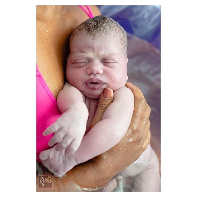 tcbirthphoto's tweet photo. 😍 #justborn #babygirl #newborn #birthphoto #birthphotogs #waterbirth #waterbirthbaby #homebirth #homebirthbaby #birth #thisisbirth #healthybaby #love #squish #birthphotogs #birthphotographer #birthphotography #loveatfirstsight https://t.co/M3gz9SSRwc