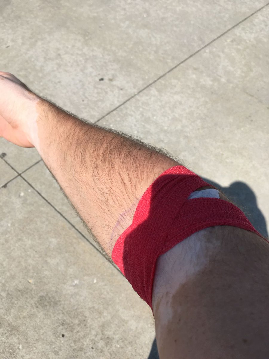 bockoclock's tweet image. Donate blood if you can 🙏

How many other ways can you help save up to three lives in less than an hour? 

#missingtypes #typeo #BloodDonation #blooddonor