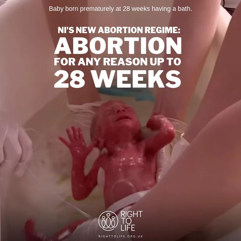 RockofLifeNI's tweet photo. Northern Ireland faces the most extreme abortion law in Europe being forced upon us by the Westminster Government on October 21st. #ItsNotInOurName #FightBack #DemandStormont 
#Not4NI #notinourname

⬇️ What can you do to stop it? ⬇️
https://t.co/DVaOfWj1Zb https://t.co/lRkhJZMP5X