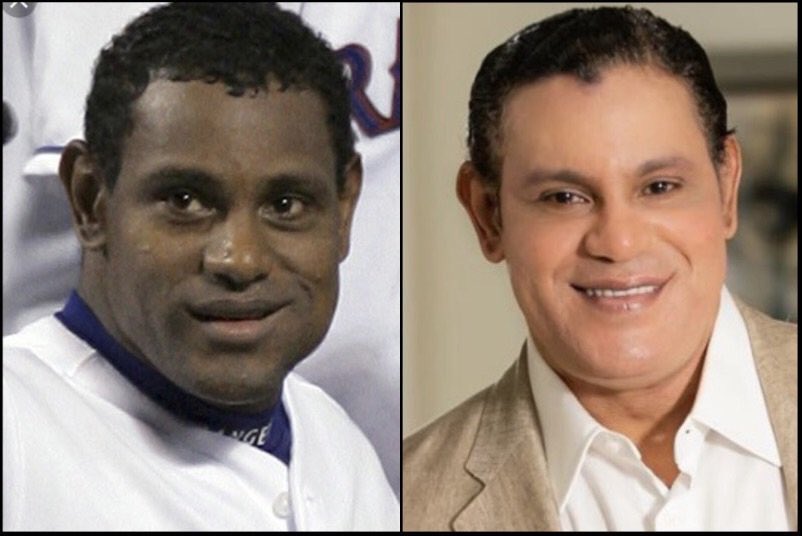 Сэмми льюис до и после. Sammy Sosa. Сэмми Льюис до. Семи Льюис до и после. Сэмми Льюис до пластики.