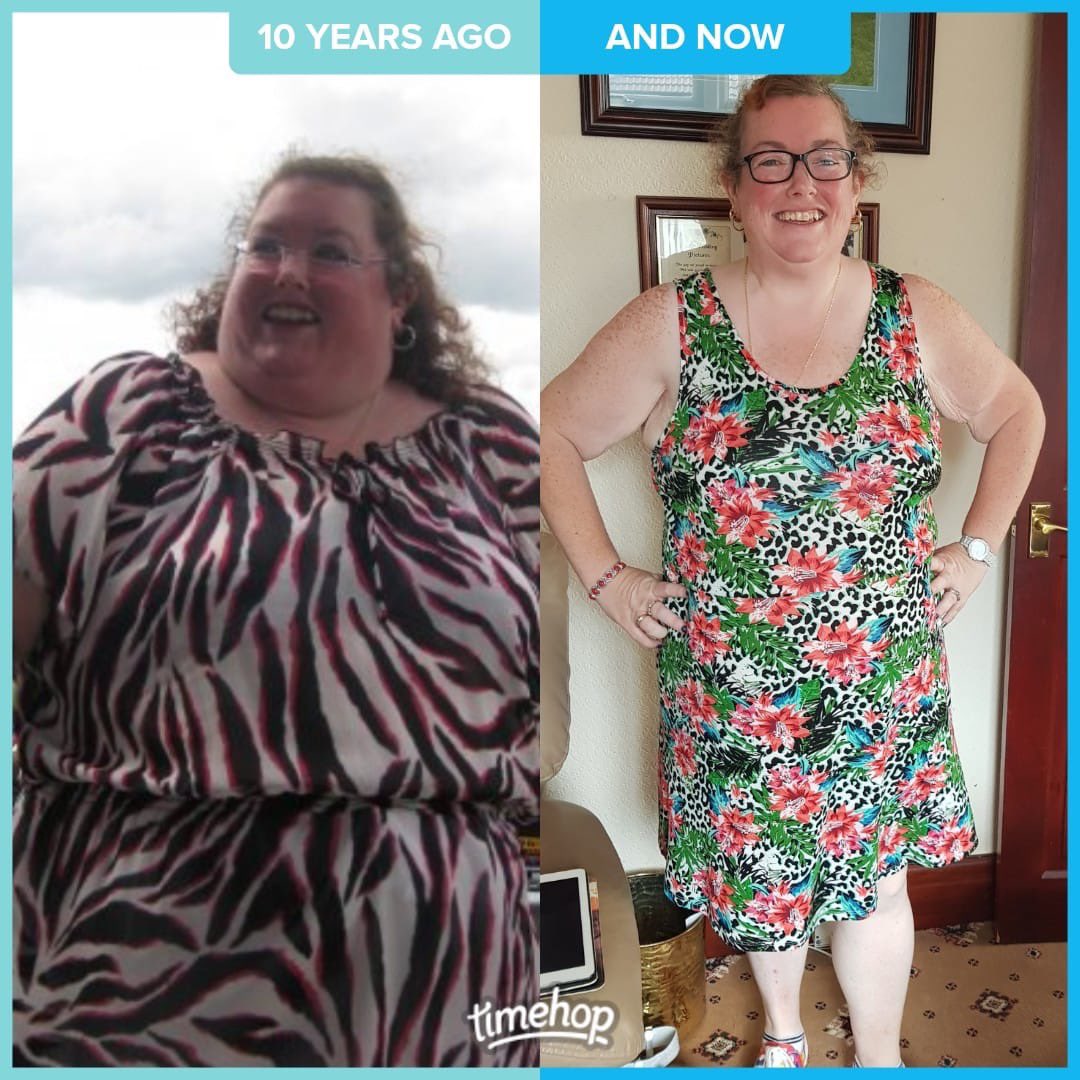 facebook.com/15929400376169…

Read about our amazing patient Michelle who has lost an incredible 11 stone over the last year.  She is no longer #type2diabetic and has ditched her #sleepapnea mask.  She’s our hero!

#weightloss #weightlosstransformation