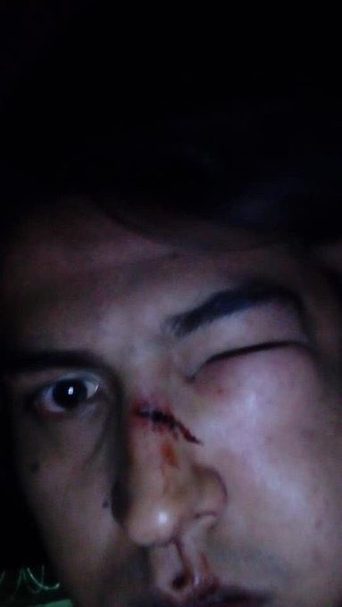 Va una condena enérgica a la violencia policial desplegada en Guadalajara y sobre la cual #EnriqueAlfaro debe rendir cuentas, determinar responsabilidades y proveer justicia/reparación a las víctimas. Inaceptable que la fuerza pública se use de esa manera. 👎