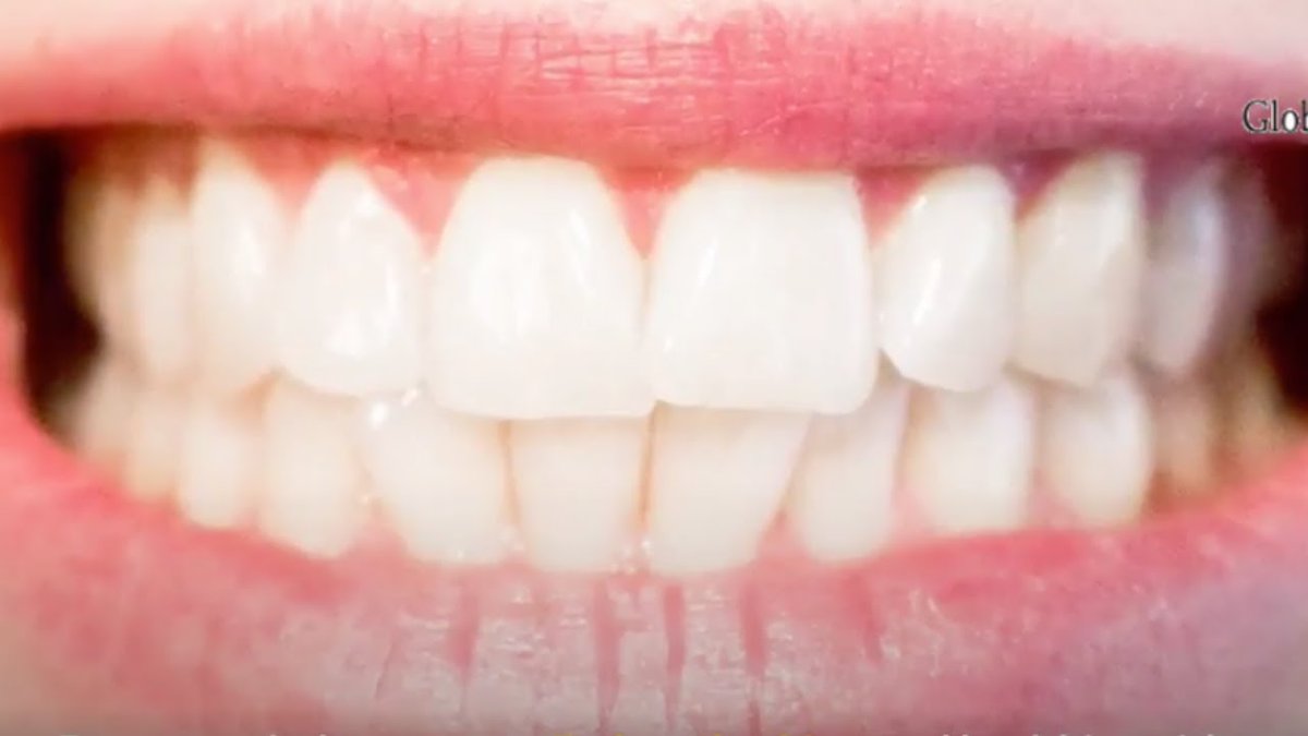 Check out my latest video "How to Have Whiter Teeth."

Watch Now: youtu.be/b07E8nXh5vM