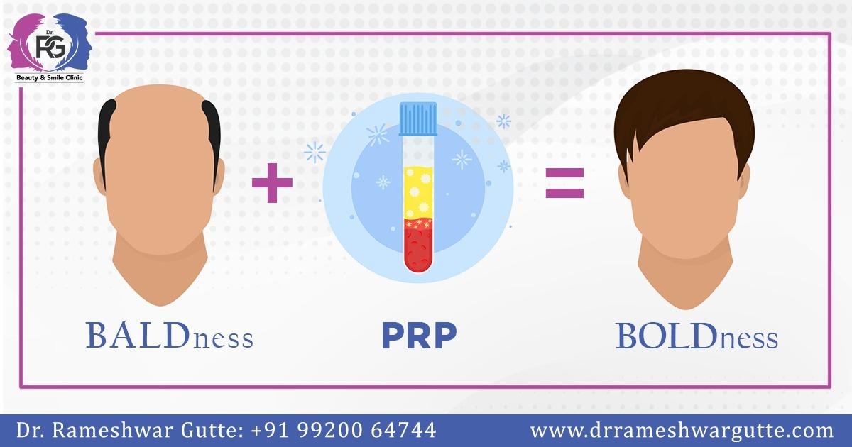 DrRGutte's tweet photo. #PRP takes you from #Baldness to #Boldness, One of the Safest &amp; Non-Invasive Ways to Regain your Hairs.
Book Your Appointment Today !

@DrRGutte  : +91 99200 64744
Location : #Powai

#DrRameshwarGutte #BestHairTransplantinMumbai #Hairproblems #FUE #FUT #hairSurgeon #Powai #Mumbai https://t.co/t7UbmGcECQ