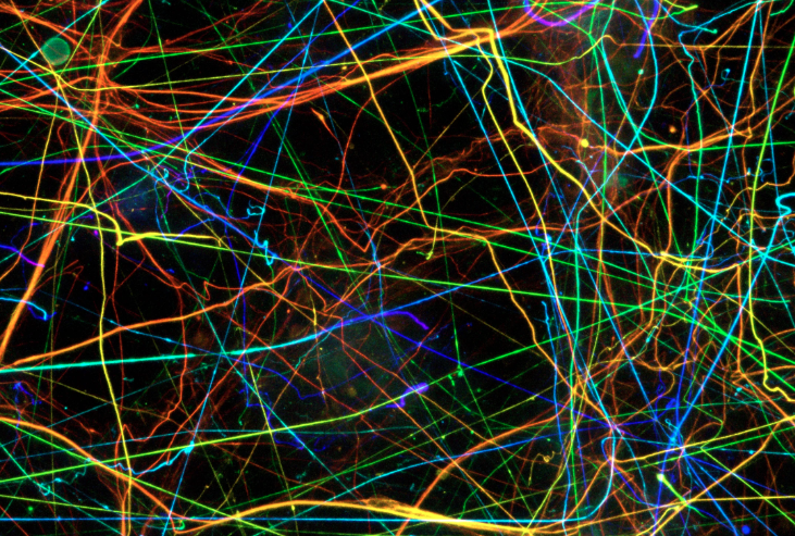 sciam's tweet photo. Bridging veins, stereocilia, glial cells, neural axons. These are some of our editors' favorite images from the annual Art of Neuroscience competition by @ArtNeuro. See all the top entries and the winner here: https://t.co/nZMXMx2RKH https://t.co/lVIK2ztO8W