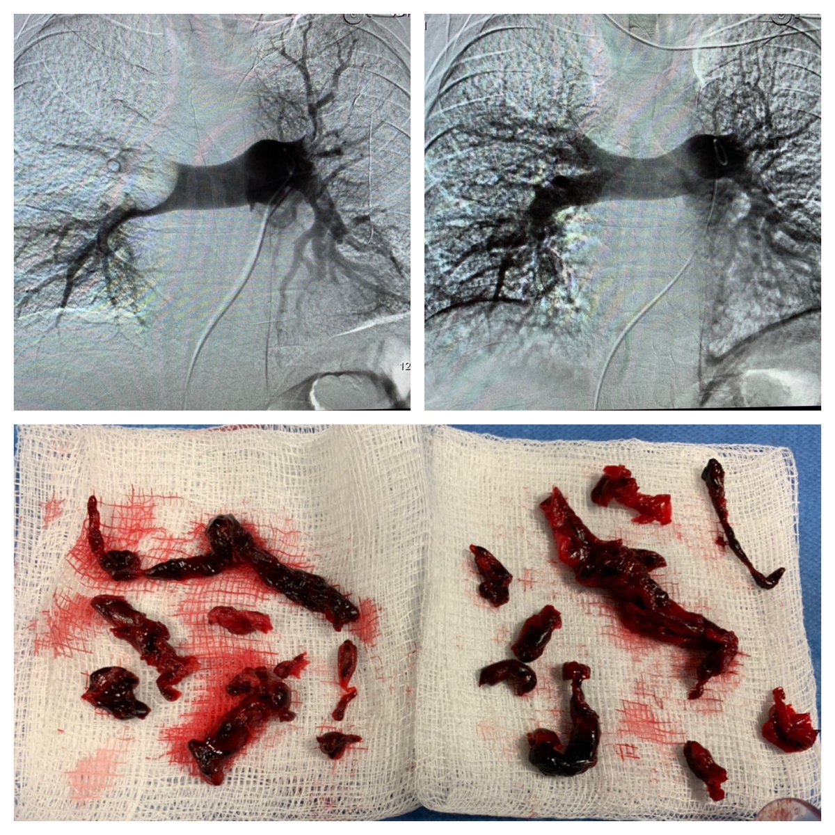 Albany IR tweet media