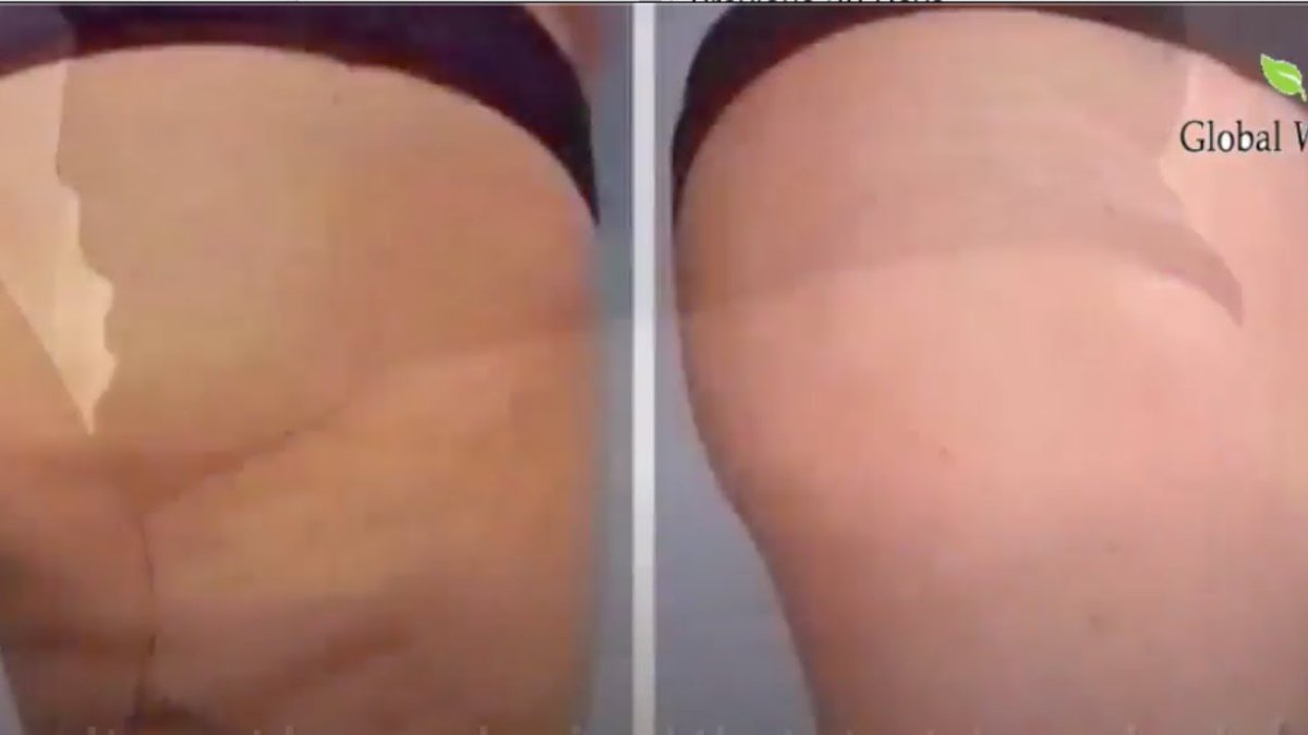 Check out my latest video "Amazing ways to prevent and effectively fight against stretch marks"

Watch Now: youtu.be/bD5Wj8iq8tk