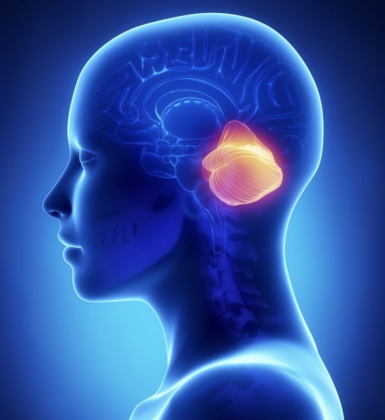 ParkinsonismD's tweet image. #SCA Caucasions vs Chinese #SCA1 #SCA2 #SCA3 #SCA6 #SCA17 progression doi.org/10.1016/j.park…