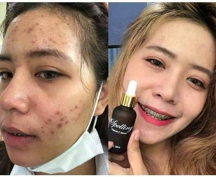 BMaleeya's tweet photo. • Serum Vit C 🍊 ช่วยให้รูขุมขนกระชับ ลดความมันบนใบหน้า ลดสิว ลดรอยดำ รอยแดง และจุดด่างดำต่างๆ บำรุงให้หน้าขาวใส
       • Sleeping Mask 🍼 ช่วยให้หน้านุ่ม ฉ่ำวาว ดูหน้าเด็กตลอดเวลา ลดอาการหน้าโทรม
#HowtoPerfect #howtobeauty #เซรั่ม https://t.co/2ZzQHDdbGi