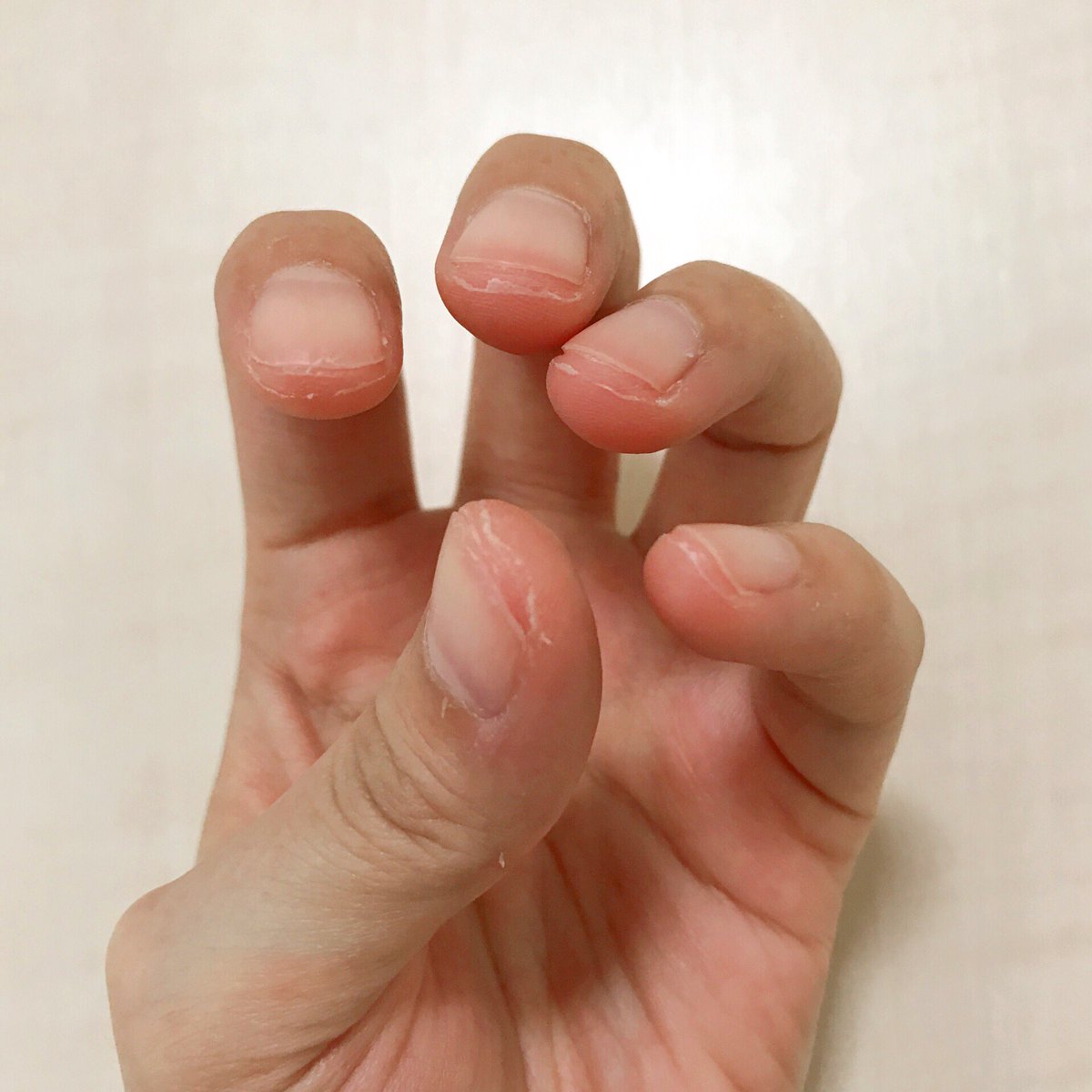 や ま か わ ま す み 指先の皮が剥けてきました 季節の変わり目です 指先 指の皮 季節の変わり目