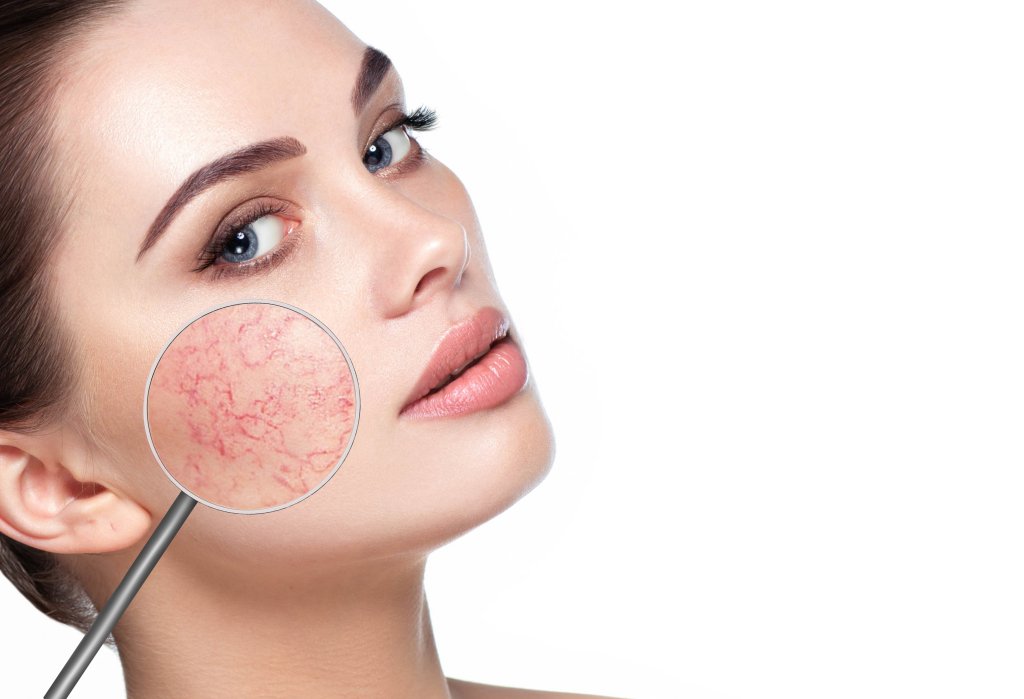Cosmetic129HS's tweet photo. Mid-life skin issues needn’t cause misery according to skin care expert, Ms Angelica Kavouni Cosmetic Surgeon. https://t.co/5idZPL4Yat https://t.co/R1tuJH4Yof