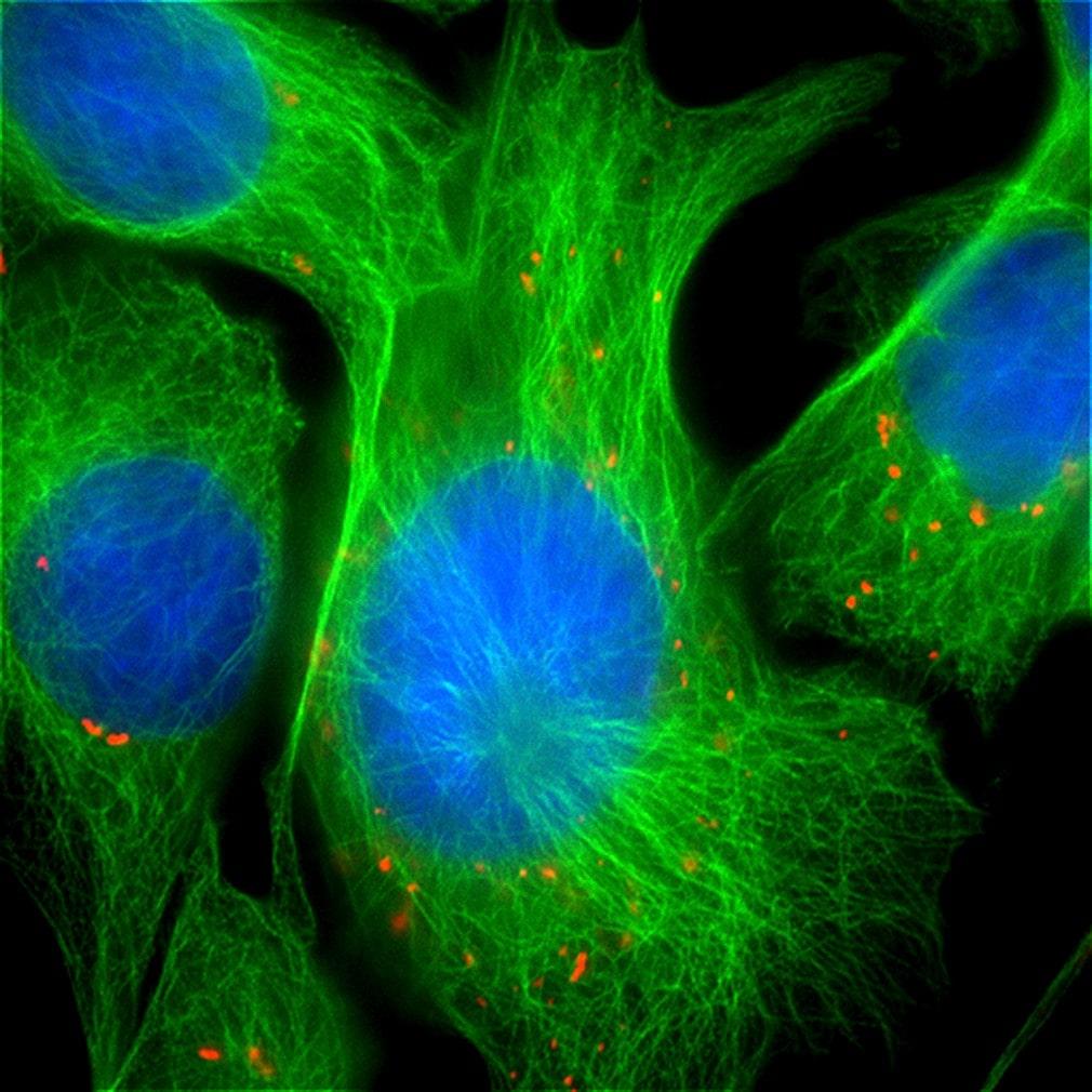 Koenzim Q10 nedir, enerji verir mi, antioksidan mı, eksikliği ne gibi sağlık sorunlarına neden olur?

caresivar.org/koenzim-q10-de…

#çaresivar #saglik #saglikliyasam #koenzimq10 #beslenme #salı