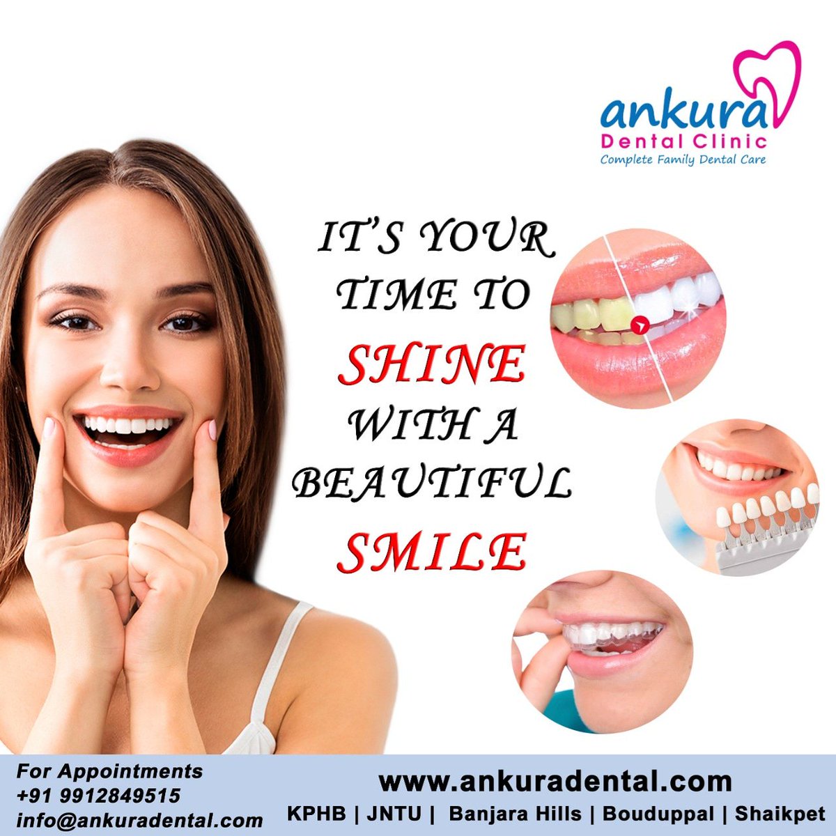 AnkuraDental's tweet photo. Aesthetic Dentistry 
#aestheticdentistry #BrightSmile #aestheticsmile #smilesmilesmile #AnkuraDentalClinic #employeehealthscheme #ankura #BanjaraHills #JNTU #Kukatpally #Boduppal #Shaikpet https://t.co/OhLp07bACr