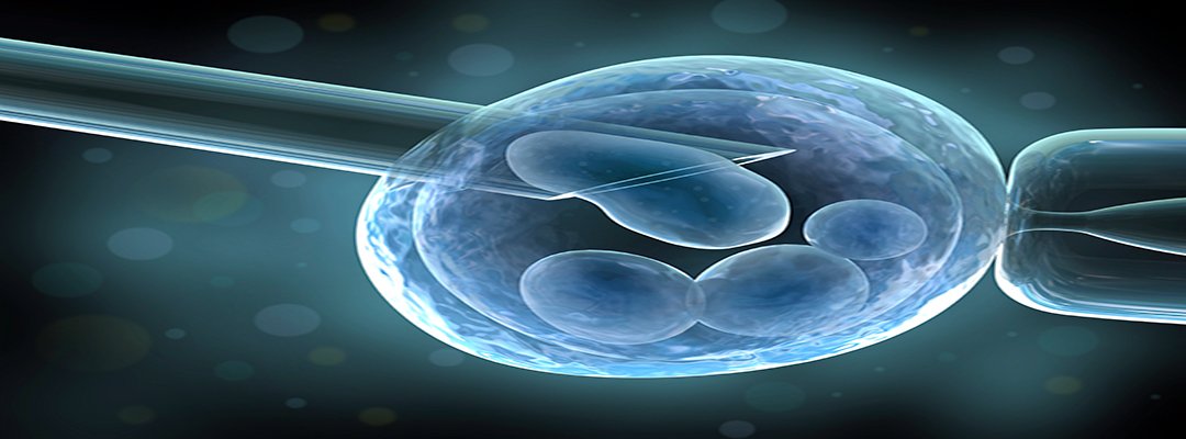 risaaivf's tweet photo. Intracytoplasmic sperm injection (ICSI) is a modern latest technique of the traditional IVF procedure to increase the possibility of fertility. This helps in improving sperm quality and its motility.
Info:- https://t.co/BUnEGlMA8X  
#ICSITreatment #InfertilieCouples #IVF https://t.co/4CDTW6bav4