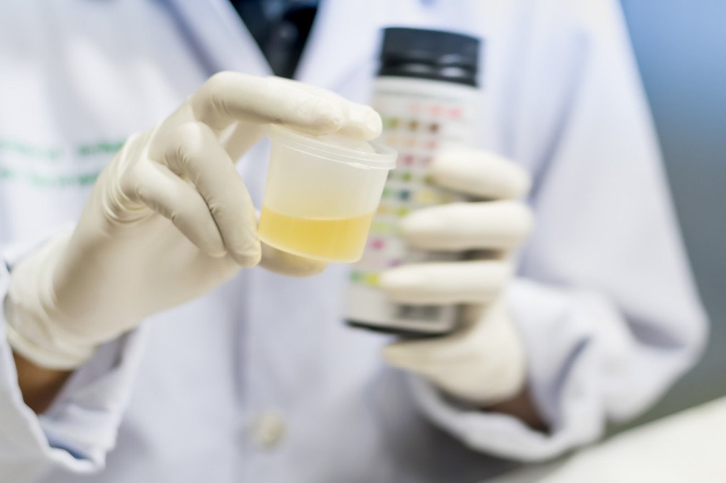RapidDetect's tweet photo. Urine Drug Test Timeline: Understanding the Window for Accurate Drug Testing https://t.co/AtgtygGPMU https://t.co/EsazkYbvIi