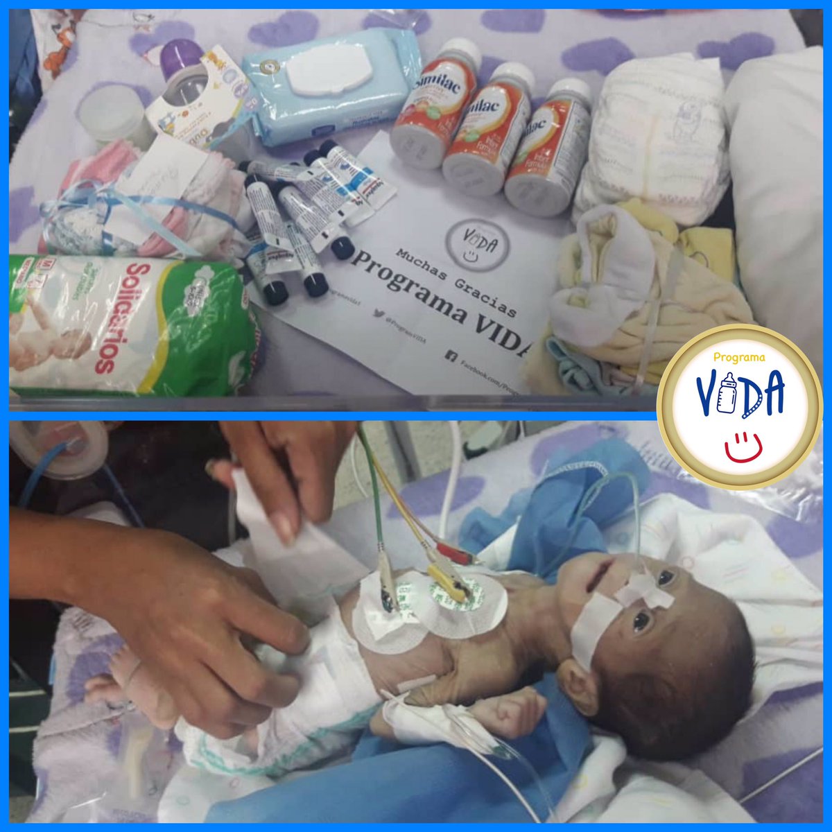 ProgramVIDA's tweet image. Ella es Arriannis Campos quien nació prematura hace dos meses pero NO recibió la atención necesaria. Hoy en día su condición ha empeorado a pesar de toda la atención su madre le ha dado. #AyudanosAAyudarla #VenezuelanHumanitarianCrisis