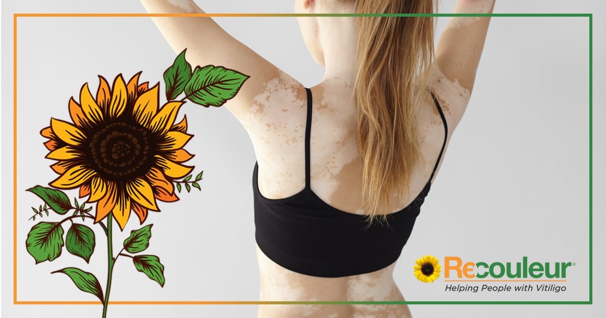 #Vitiligo can affect your overall well-being… it’s not easy watching your appearance slowly change. Read about #vitamins or buy #Recouleur® Vitamins at Recouleur.com #paidadvertisement