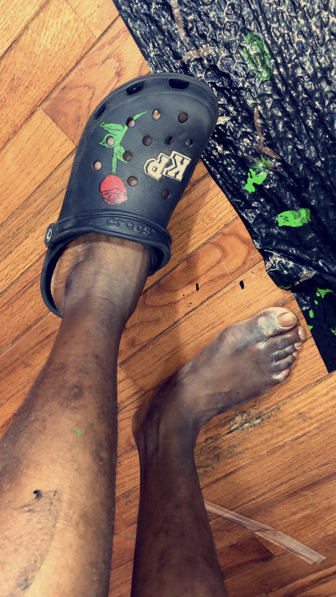 crocs with feet painted on them