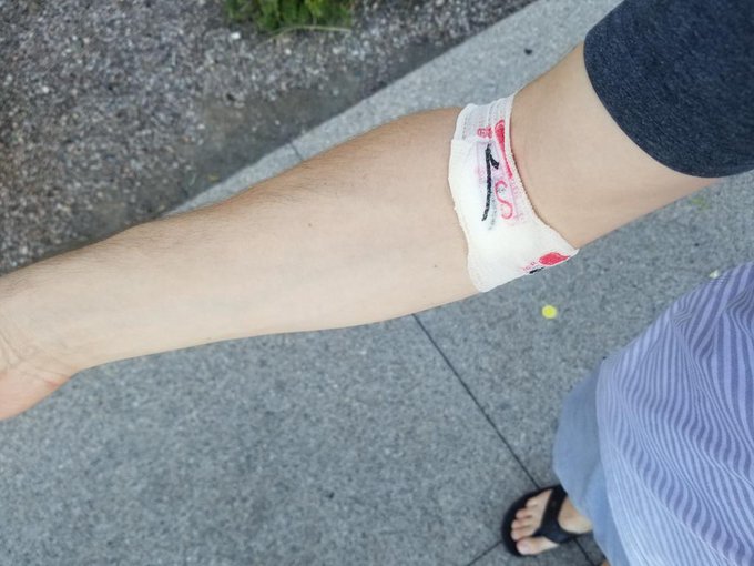 If you see someone out and about with one of these on.. You know they do the porns 🤗🙊💪💯😉 https://t.c<a href="/tag/mvsales"class="tags"><span>#mvsales</span></a>
