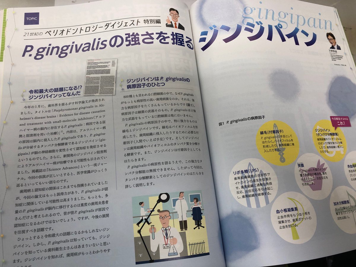 shikaeiseishidh's tweet photo. アルツハイマー病の原因が、歯科ではおなじみP.g.菌の分泌するタンパク分解酵素ジンジパインにあるという論文が今話題になっているのをご存知でしょうか？ TOPICでは、歯科医療者として知らないわけにはいかないこのジンジパインについて解説します！
#ジンジパイン #gingipain #天野先生 https://t.co/9Gy0BhT0x9