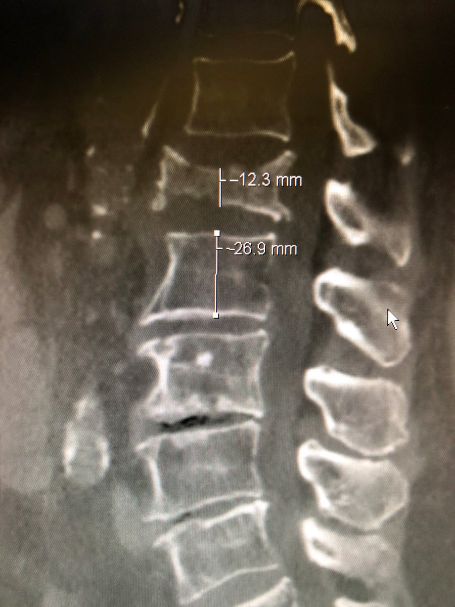 Christopher Paul, MD tweet media