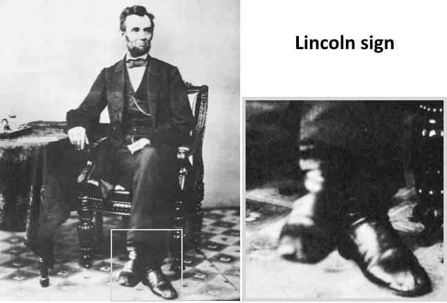 6/ Lincoln also had an eponymous sign named after him, "Lincoln Sign", where his foot was noted to bob with his pulse, leading to blurring in photographs. This was later associated with aortic regurgitation/root aneurysms https://www.ncbi.nlm.nih.gov/pmc/articles/PMC1518411/?page=1