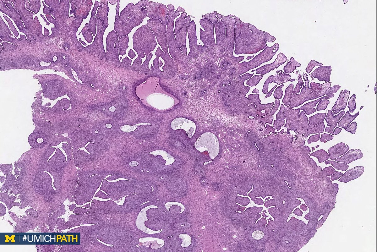 Michigan Pathology tweet media