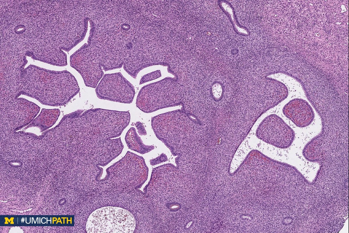 Michigan Pathology tweet media