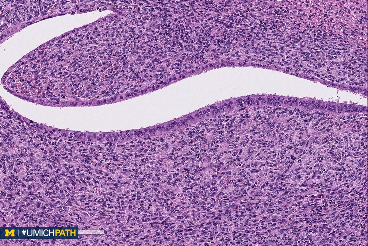 Michigan Pathology tweet media