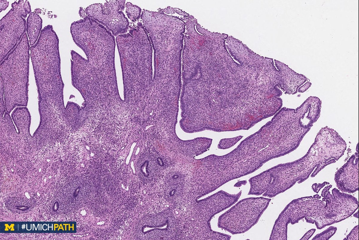 Michigan Pathology tweet media