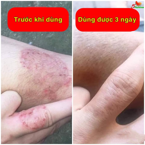 5phutkhoe's tweet photo. Bạn vui lòng đọc thêm thông tin và mua tại website: 
https://t.co/5N6IzieL2n
Chúc bạn nhiều sức khỏe https://t.co/VZ3MrFzaiZ