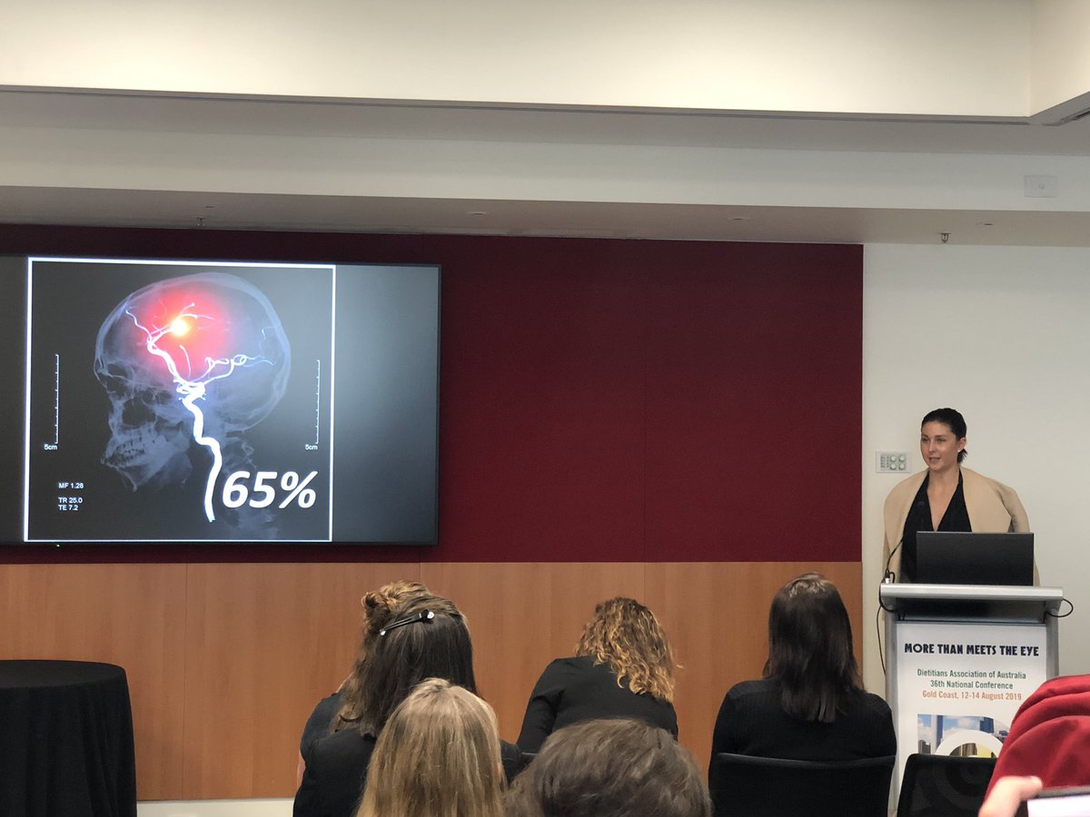 DrSkyeMarshall's tweet photo. “Being the face but not the architect” #BondDietetics Alumna Alexandra Lindeberg explores the barrier faced by nurses in giving #stroke patients #texmod diets they didn’t understand and were embarrassed by. #APD “we’re all in this together”! @DAA_feed #DAA2019 https://t.co/itx550DhG1