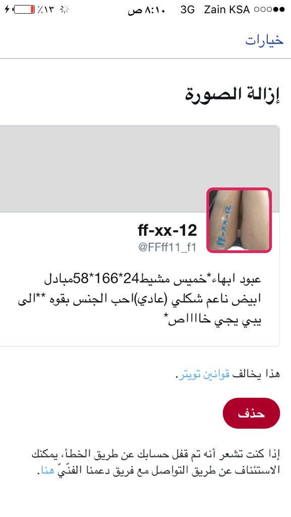 aa11aa_1122's tweet photo. حسابي تهكر https://t.co/2STMg1kf6W