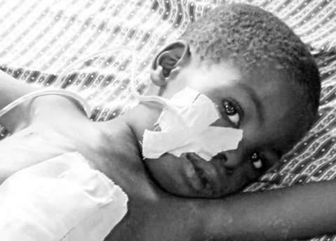 MalawiMedJ's tweet photo. An adolescent with multi-organ involvement from typhoid fever
Typhoid fever is usually a mild clinical disease, but it can have potentially serious complications. Here, we describe a case of an adolescent male with typhoid fever....https://t.co/nFsu6UZIYo https://t.co/KiXg9OSfFY