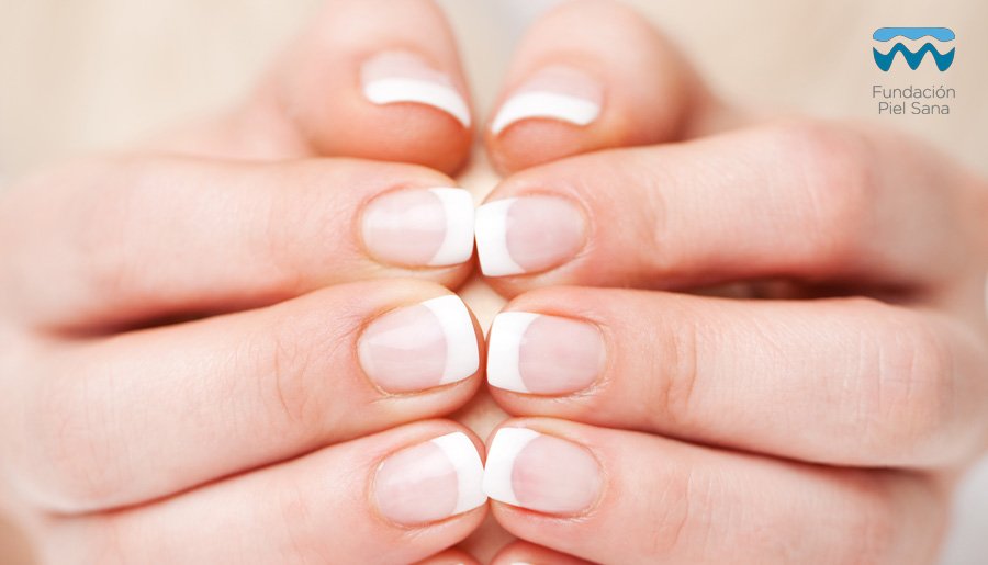 pielsana_aedv's tweet photo. #dermatología | Infecciones de las uñas por #hongos, son un problema muy frecuente. Aunque pueda parecer leve es importante tratarlo porque puede ocasionar infecciones por hongos en otras zonas o infecciones más graves en la #piel https://t.co/RTu1LDmRem https://t.co/oIbiYmLs2g