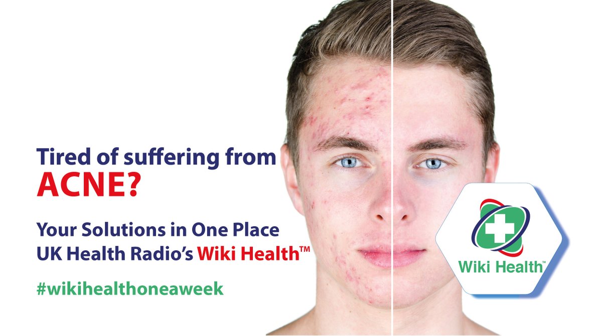 WikiHealthTM's tweet photo. Are You suffering from #Acne? Symptoms &amp; Treatment Options available at @ukhealthradio's @WikiHealthTM our #health platform. A NEW condition is added every week, to our already extensive lineup. Be Part of Your Healing Process #wikihealthoneaweek 
https://t.co/UeXUKAoqgW https://t.co/Ey33zNzBwy